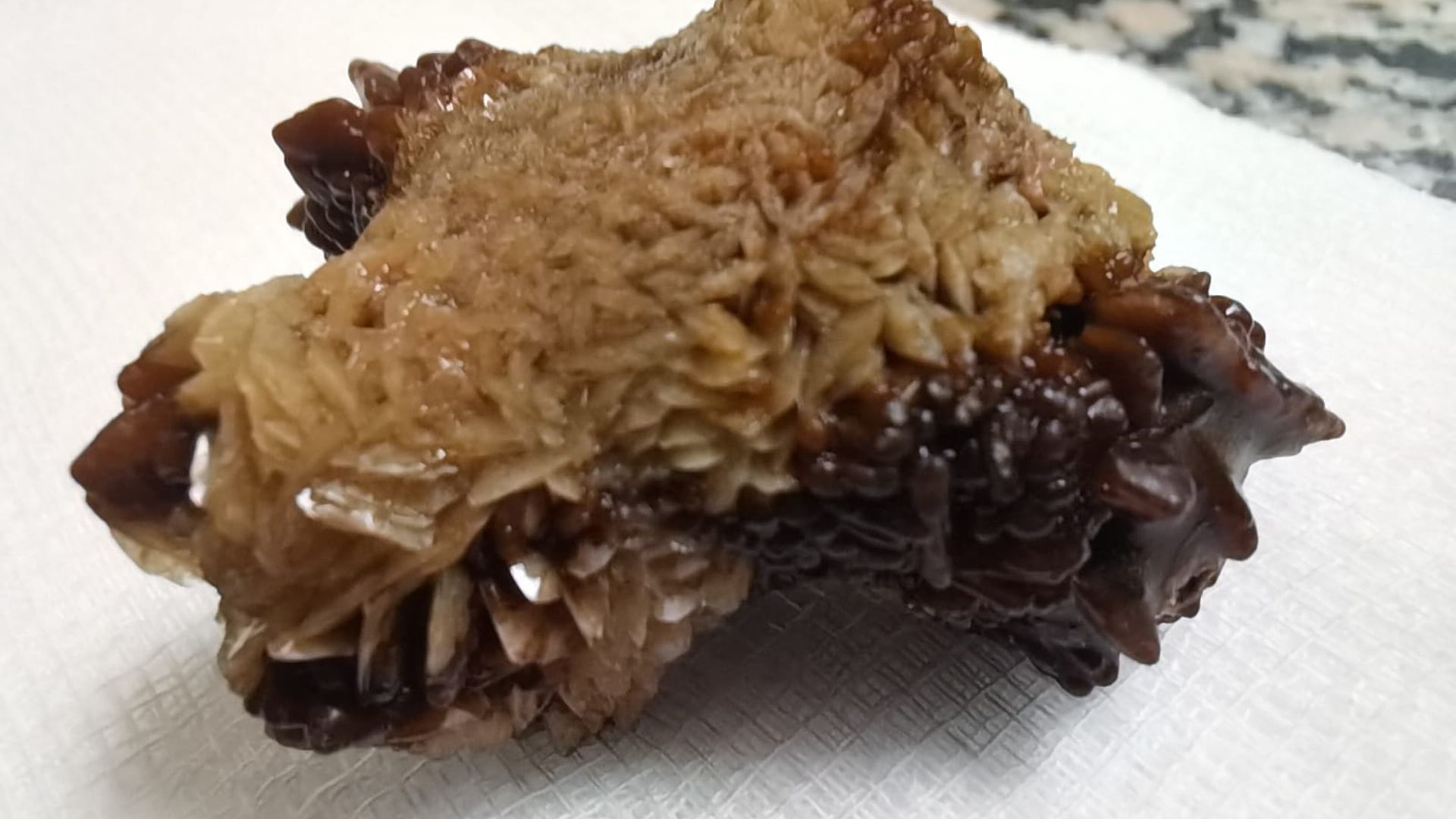 مادبا: عملية نوعية لاستخراج حصوة كبيرة من الكلى باستخدام المنظار